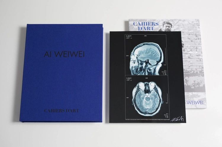 Brain Inflation_Ai Weiwei